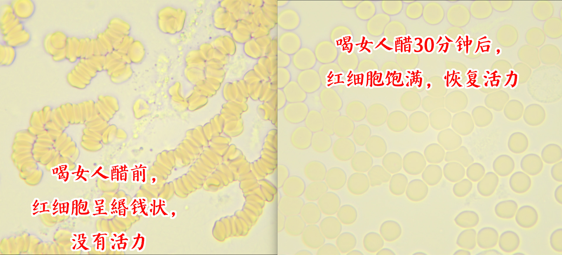 喝女人醋30分钟红细胞对比.jpg