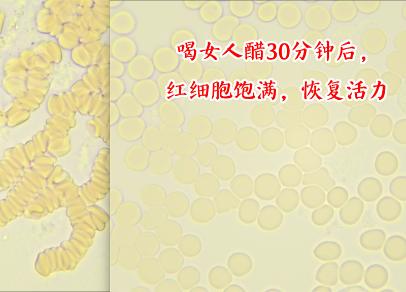 刘总饮用人参燕窝女人醋半小时后，细胞活力增强，补充气血